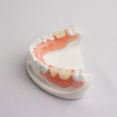 Partial Denture