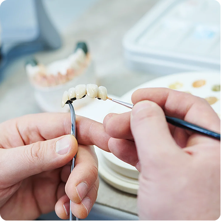 Denture Expertise