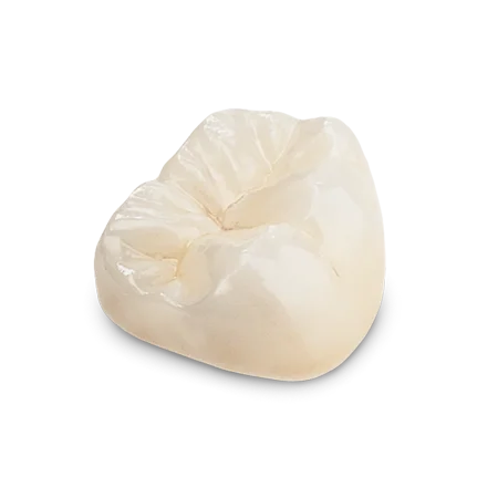 Solid Zirconia Crown
