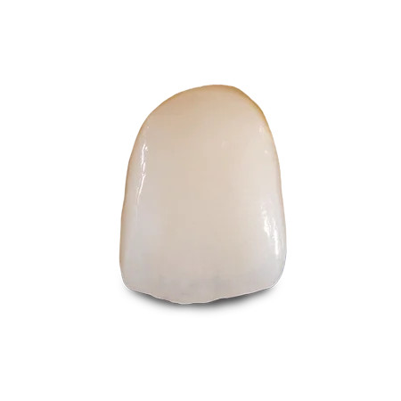 IPS e.max®