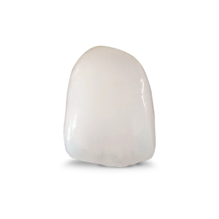 Porcelain Veneers