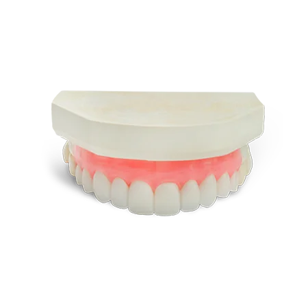 Diagnostic Wax-Ups