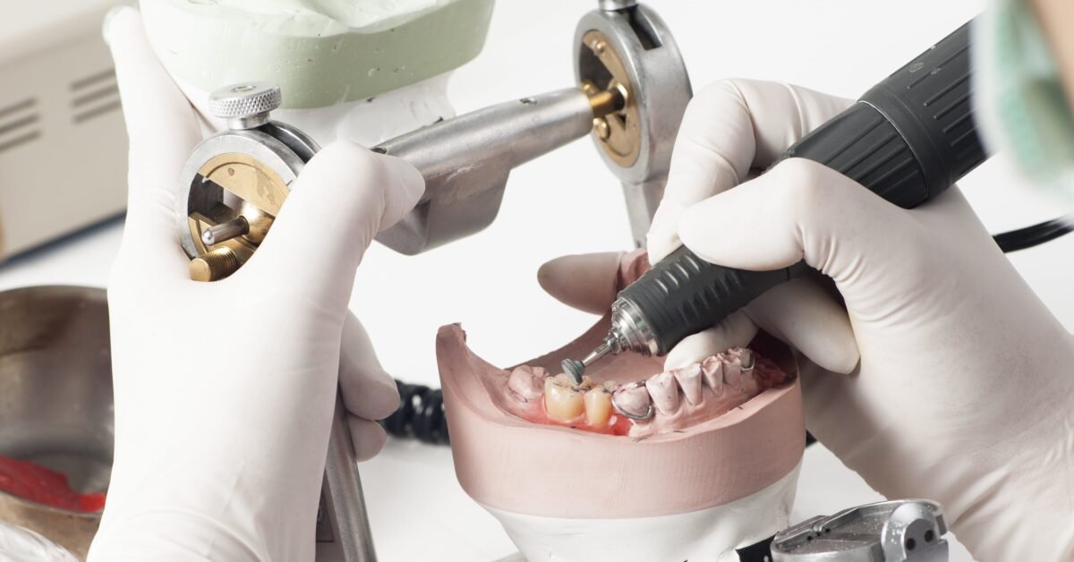 River City Dental Laboratory: Your Partner in Achieving a Healthy Smile