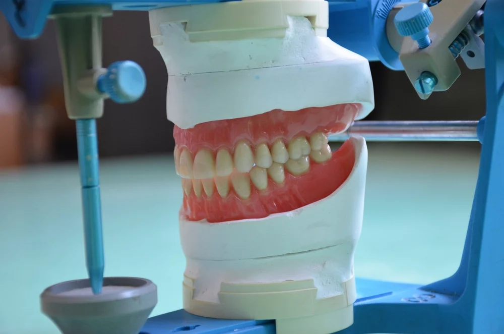 Benefits of Custom-Made Partial Dentures