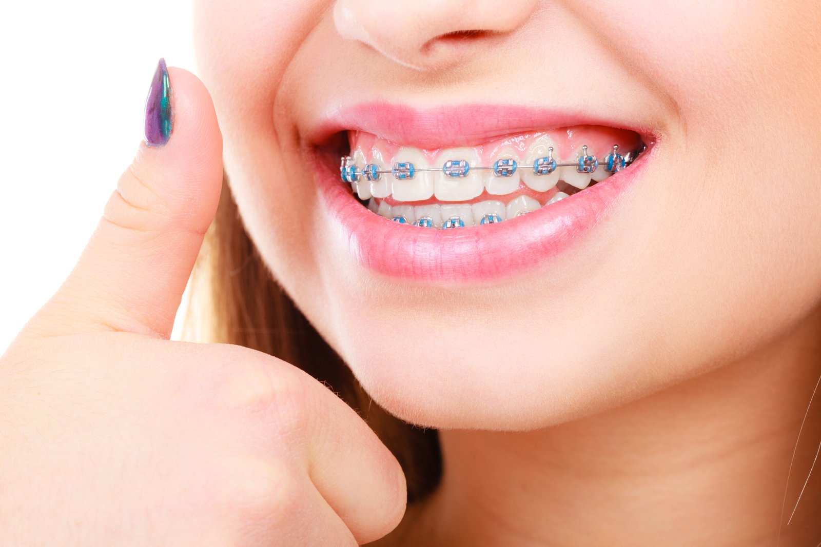 Orthodontics Near You: A Guide to Achieving a Straight, Healthy Smile